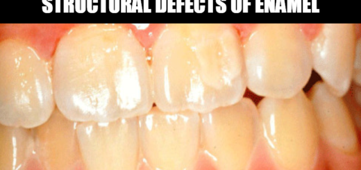 Structural Defects Of Enamel
